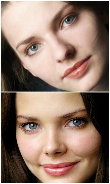 Боярская елизавета до и после пластики носа фото