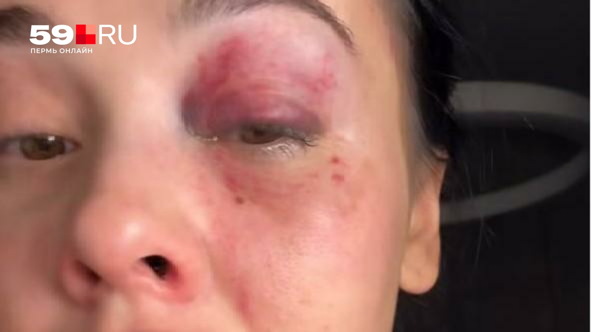 Жена бойца ММА из Владивостока рассказала о многолетнем абьюзе и угрозах
